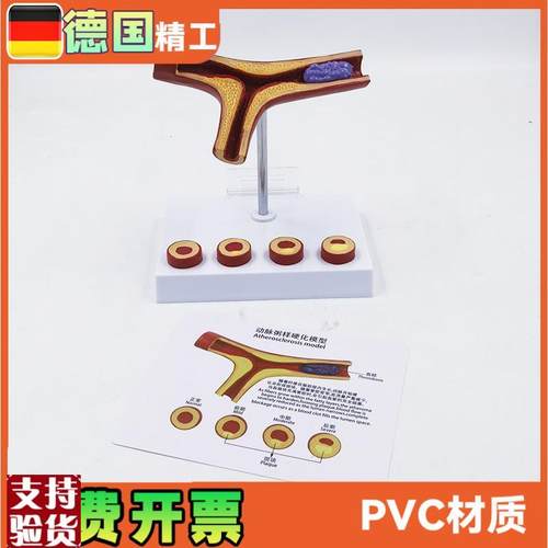 德国】动脉模型血栓冠心血管解z剖教学医药礼品健康管理教具医学