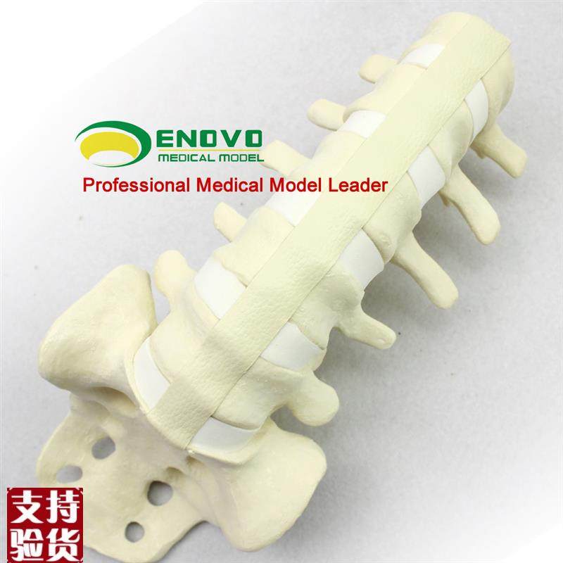 ENOVO颐诺人体仿真腰椎尾骨模型骨科手术前SawboTne人体腰椎钉棒,文具电教/文化用品/商务用品,教学标本/模型,淘宝优惠券,粉丝福利购,淘宝优惠卷