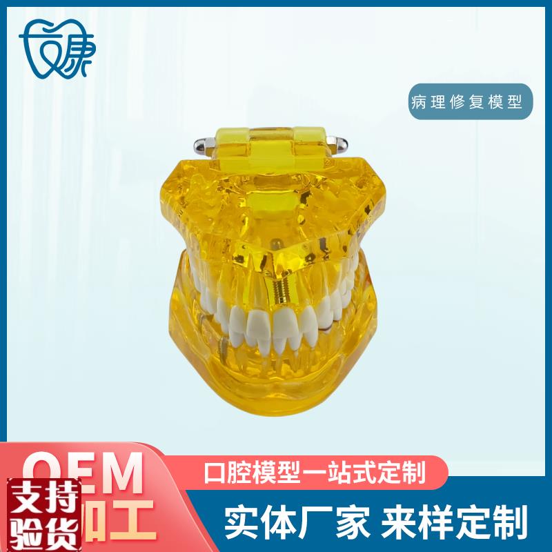 牙齿模型病e理修复可拆卸正畸口腔病理牙模型牙科医患活动沟通