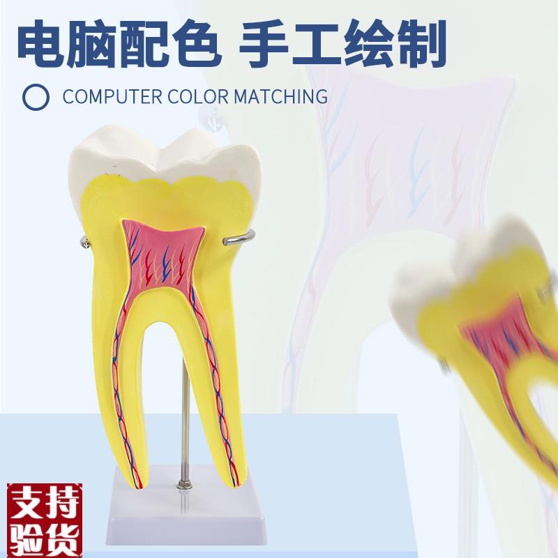 人体磨牙解剖模型幼儿园教具医学教学大型牙齿T通用配底座支架