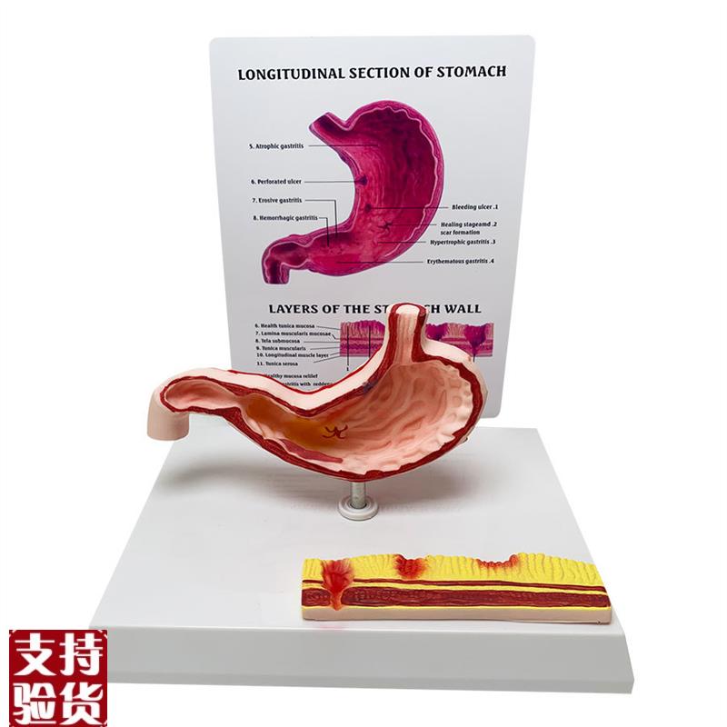 人体胃部消化系统解剖模型内脏解剖H胃炎教学医学教具厂家直销