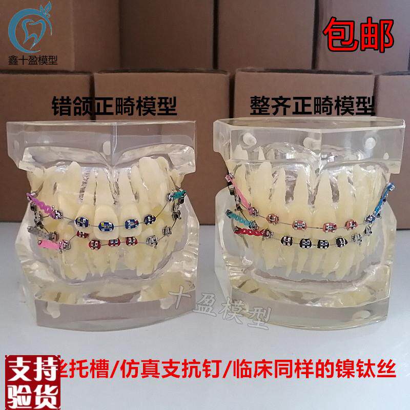错颌矫正展示扎丝托槽正s畸牙齿模型牙模牙科模型牙齿模型口腔模