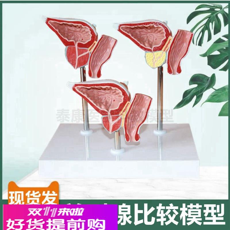 前列腺模型男科生殖泌尿器官膀胱肾脏解剖内外生殖器睾丸内分泌腺