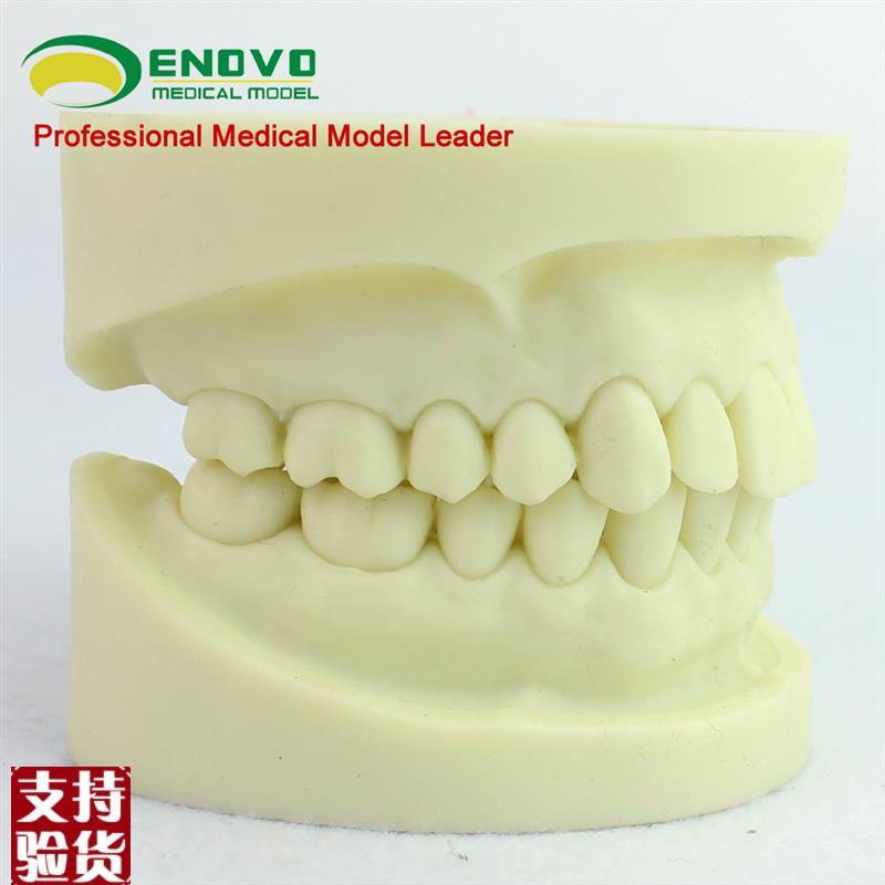 ENOVO颐诺白刚玉o牙模型牙体预备操作制备练习离体牙洞备牙医练