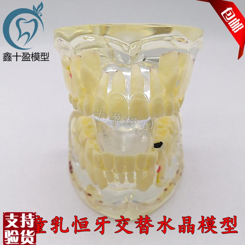 牙科口腔教学模型儿童病理模型乳牙恒牙交替L透明水晶模型M4002