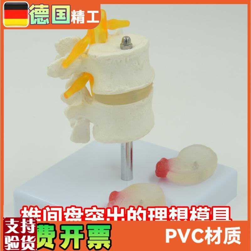 人体腰椎模型椎间盘脊神经根骨B骼解剖医药礼品教学展示用道具