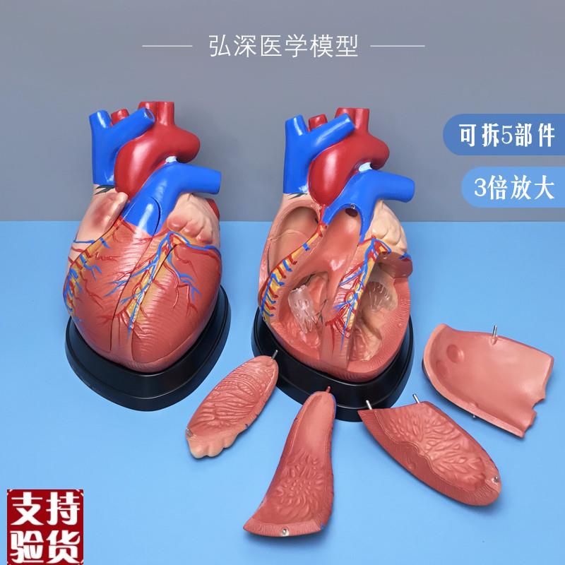 心脏模型放大3倍人体内脏器官血管解剖结构可拆5部U件医学教学模