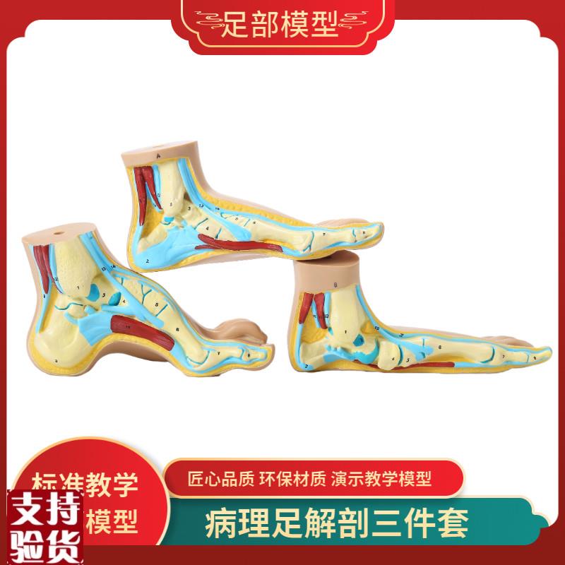 脚模型正常足扁平足弓型足v解剖模型脚部构结构造肌肉血管教学医