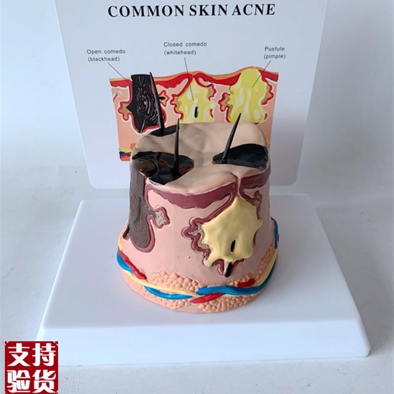 放大皮肤结构解剖模型组s织层次皮肤构造模型具微整形缝合美容教