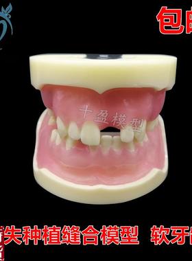 牙科缺失c种植模型缝合练习牙模仿骨质牙齿上颌窦提升术m2002