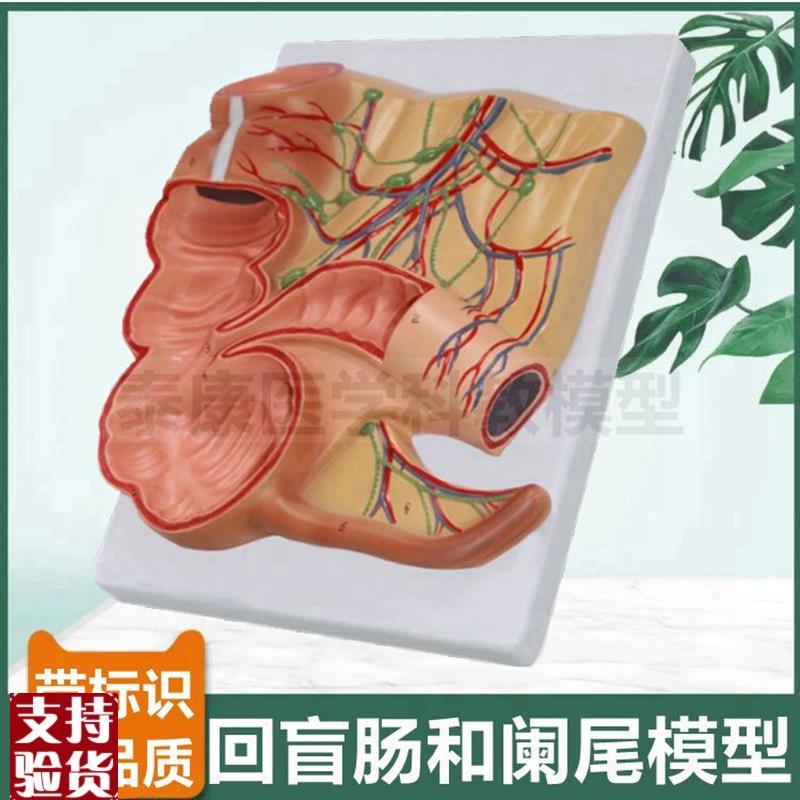 大肠模型肠系膜血管回肠盲u肠阑尾结肠病理肛周直肠痔疮肛肠医生