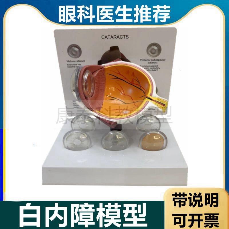 白内障模型青光眼眼睛p浑浊视力下降老人眼球解剖视网膜眼底结构