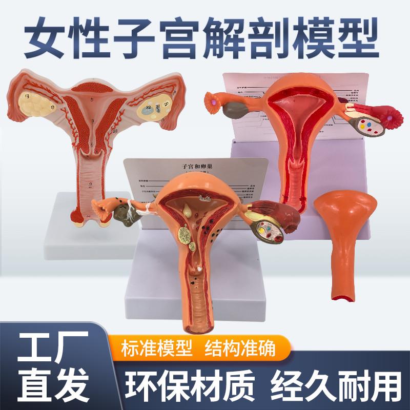 人体模型女性生殖子宫模型阴道卵巢E模型教学模具病理变化科普教
