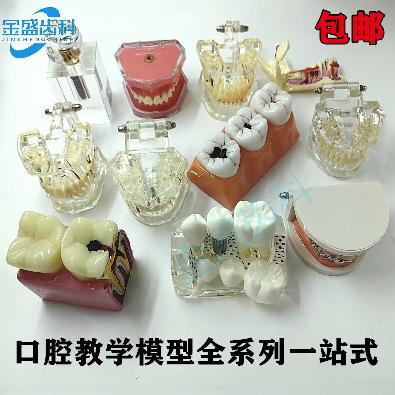 牙科口腔教学模型标准牙s模种植修复病理模型双色恒牙医患沟通