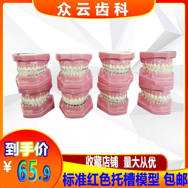 牙科口腔正畸托槽k教学练习模型全金属托槽矫正医患沟通牙模型包
