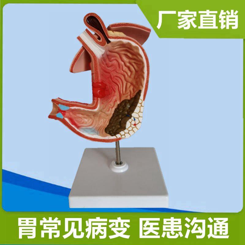 病理胃模型医药礼品展示胃粘膜有孔消化器K官医用解剖教学生物器