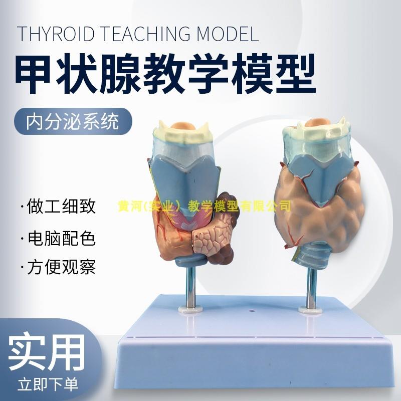 进口jia状腺病理模型甲亢模型甲状腺病lQi模型甲状腺结节