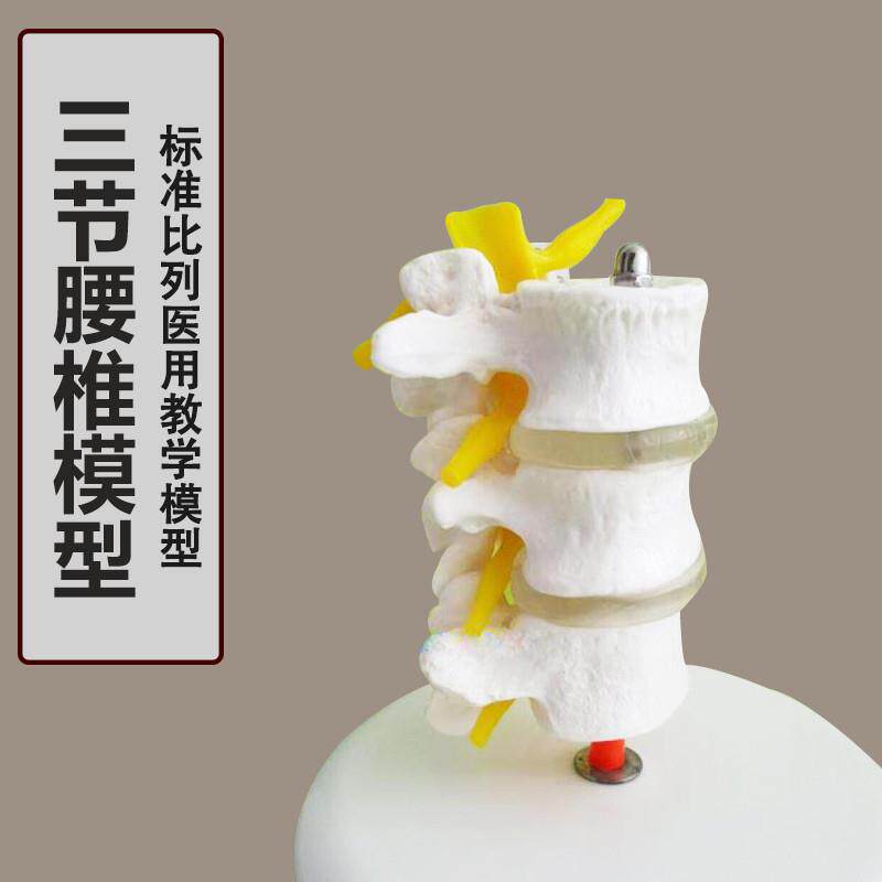 厂家直销新f款3节腰椎模型腰椎骨骼椎间盘神经根模型脊椎模型