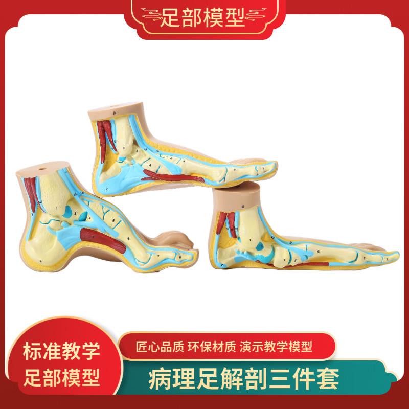 脚模型正常足扁平足弓q型足解剖模型脚部构结构造肌肉血管教学医