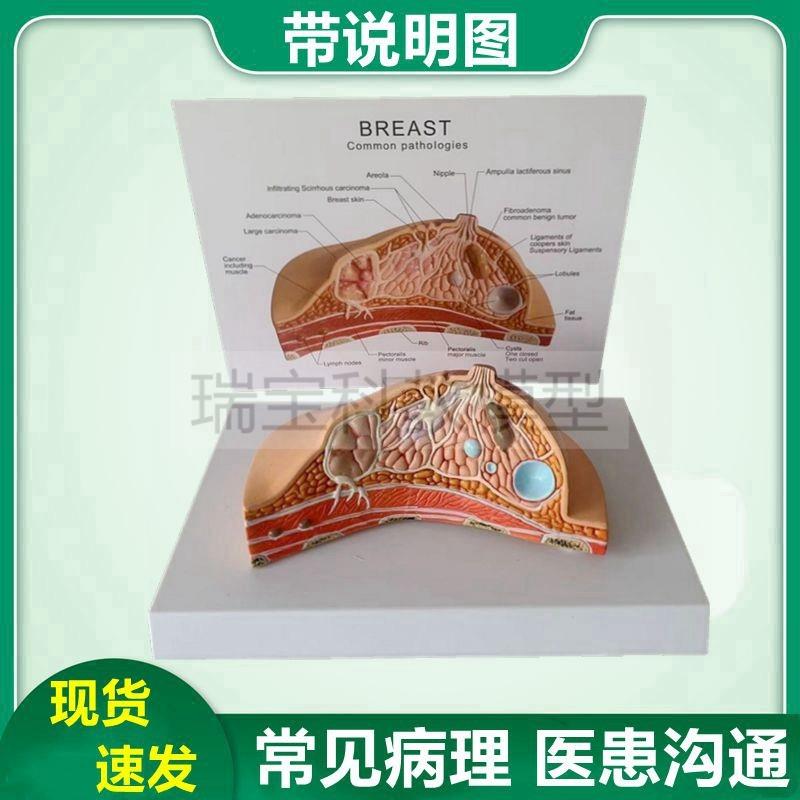 女性乳房模型乳腺解剖胸部美容哺乳期乳房月子中心月.嫂培训病理