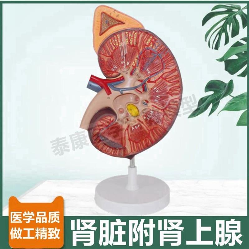 人体肾脏模型肾i上腺放大审单位肾小球蛋白尿形成尿液泌尿器官病