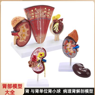 人体肾解剖模型病变肾脏模型肾单位肾小球人体内脏器.官解剖模型
