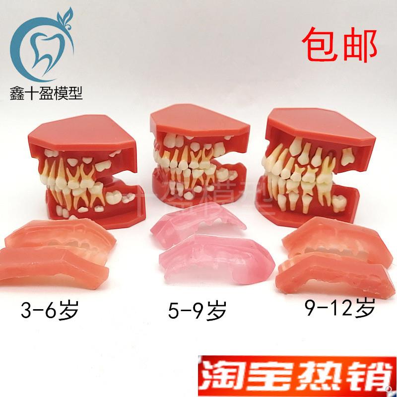 儿童乳牙替换牙齿模型乳恒牙交替3D个阶段口腔59髓牙列发育模型