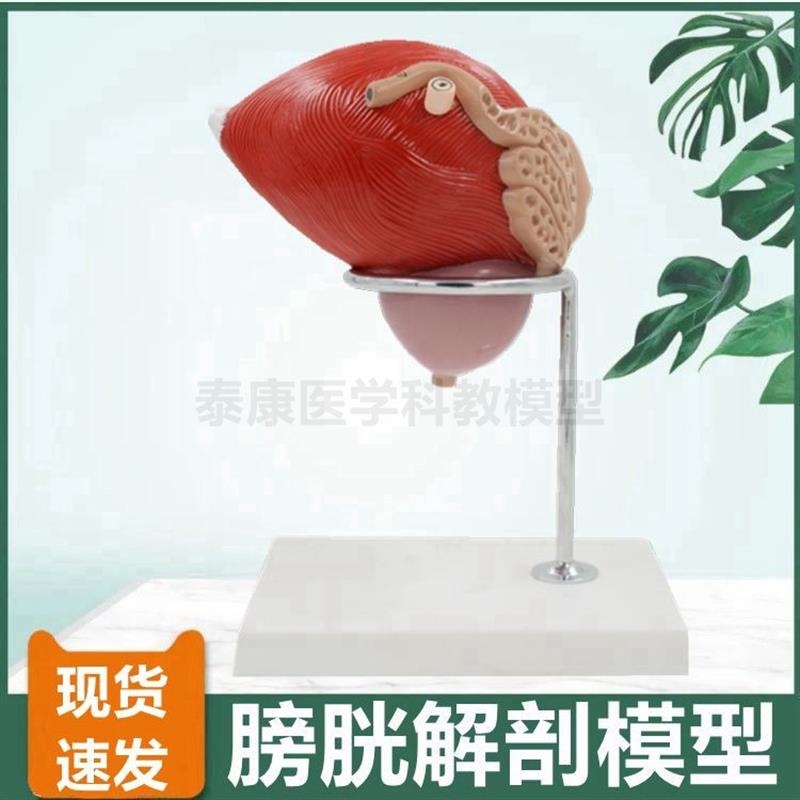 膀胱模型生殖泌尿器官前列腺健康病变比较中老年人肾Y脏男科医患