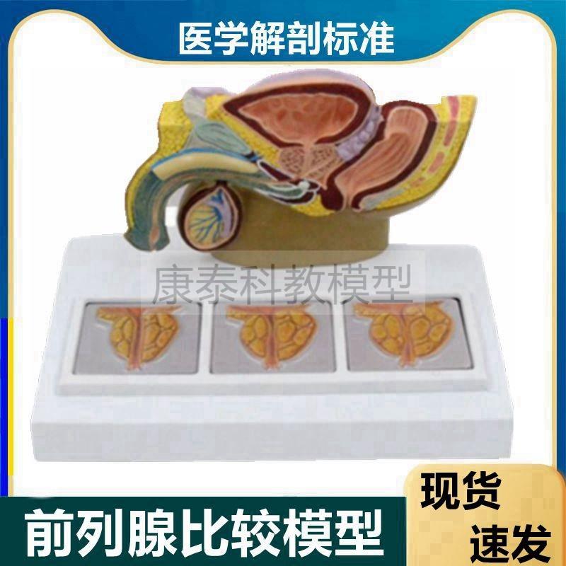 前列腺模型男性生殖病理肥增大中老C人泌尿道临床医用教学医药礼