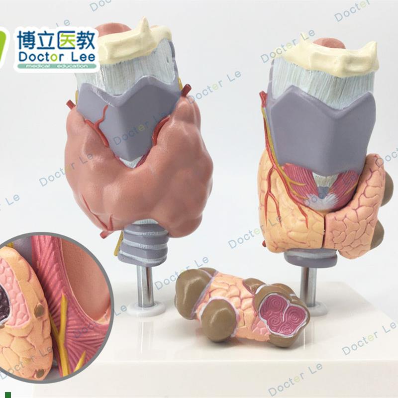 人体甲状腺病理模型甲v亢甲低甲减内分泌系统医学解剖