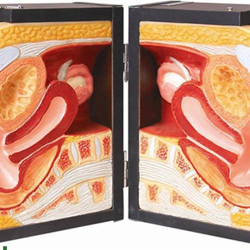 高级女性避孕器指导模型,教学模型计生M办教育模型,医学模型