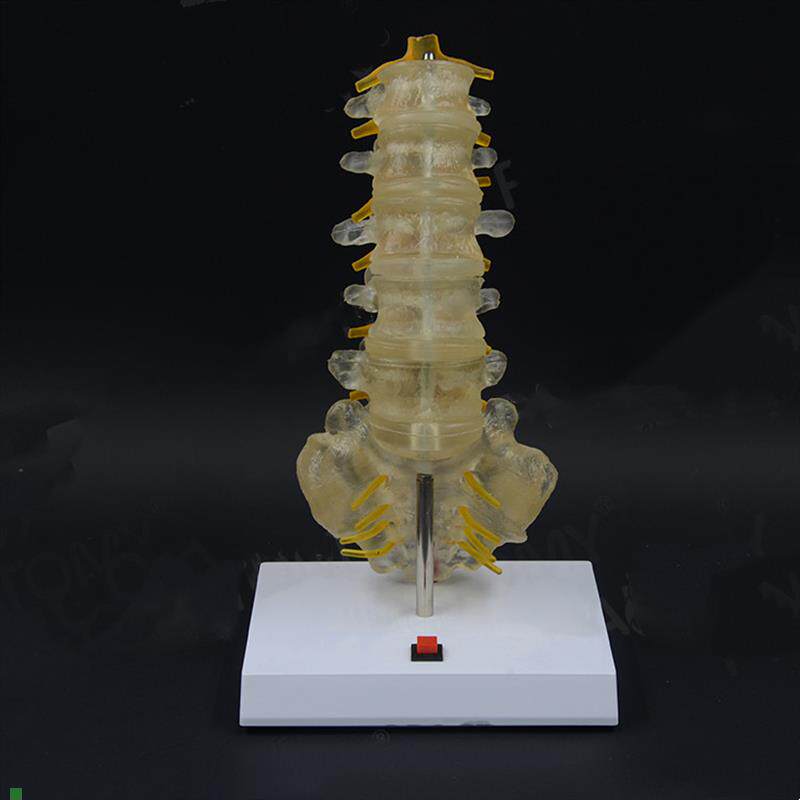 腰椎模型灯光控制人体脊柱结构椎间盘突J出压迫神经骨科病理示教
