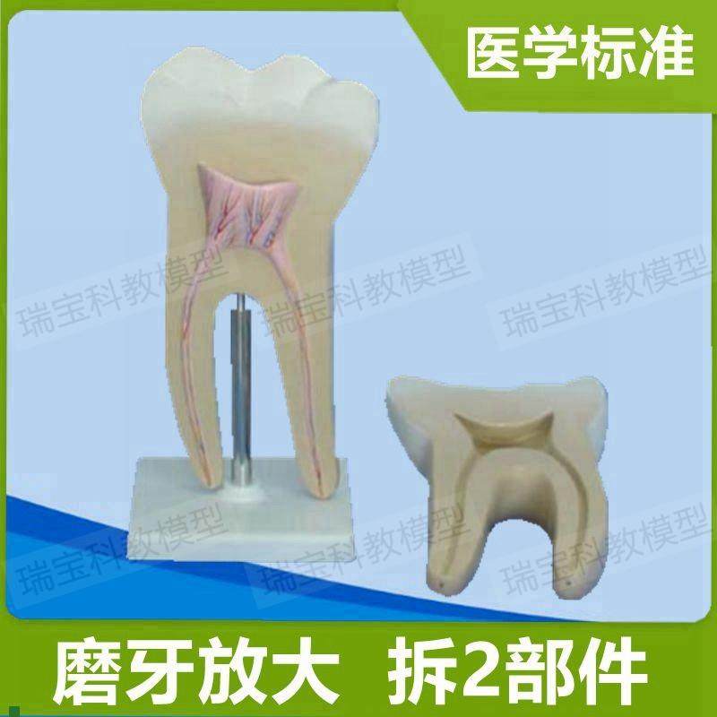 磨牙模型可拆f卸牙髓根管解剖蛀牙龋齿牙科健康宣传口腔科普展示,玩具/童车/益智/积木/模型,其他模型玩具,淘宝优惠券,粉丝福利购,淘宝优惠卷