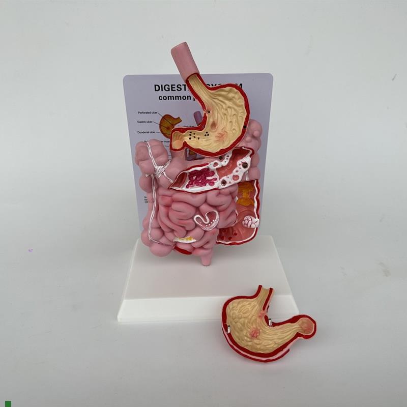 病理消化系统模型胃m剖面大肠小肠解剖模型医学展示教学讲解科普