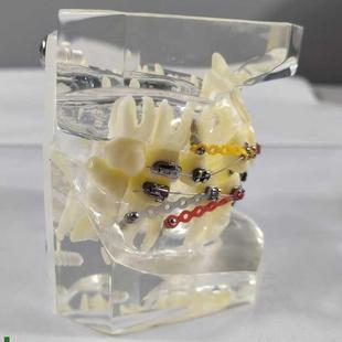 透明正畸撮合矫正模型透明水晶托槽展H示结扎丝托槽正畸带支抗钉