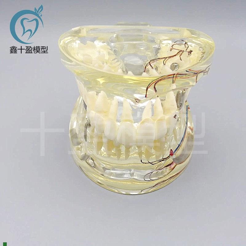 牙科水晶牙齿病理模型M4019-2成人透I明病理牙模型带牙神经和嵌体