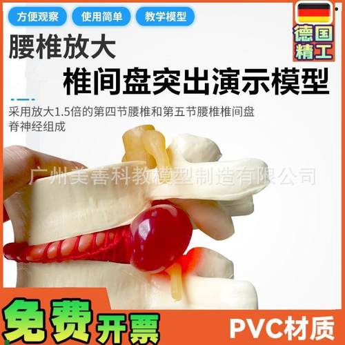 椎间盘模型正品医学人体腰t椎突出脊柱脊椎骨病理演示关节标准模