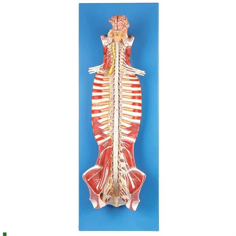 椎管内部脊髓神q经模型GD/A18102