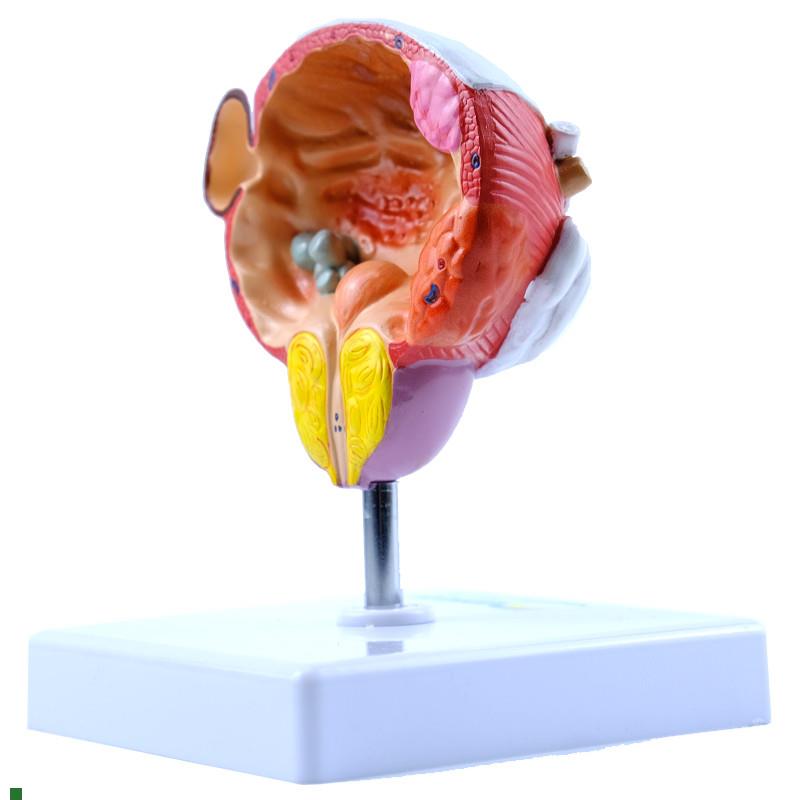 ENOVO颐诺人体膀胱前列腺疾病演示模型男性O泌尿外科医患沟通男科