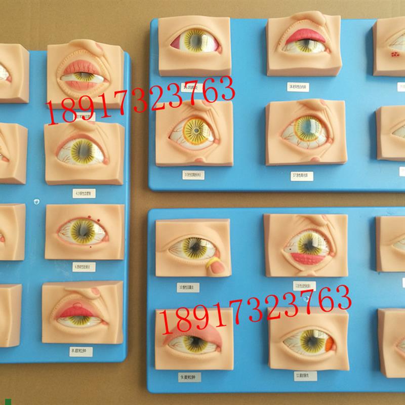常见眼病模型20种眼睛疾病模型眼科J常见疾病模型眼球病变模型