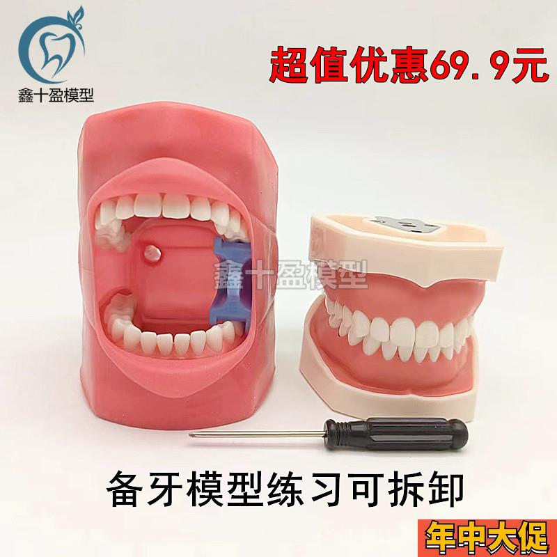 口腔备牙模d型仿真牙齿模型练习备牙粒离体牙口腔考试教学软牙龈