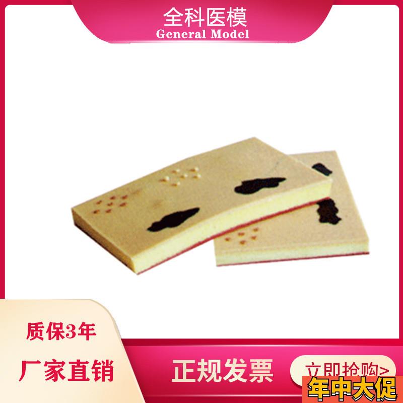 表皮常见病表处理u训练模块GM/W00103