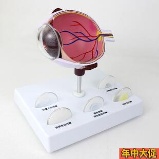 ENOVO颐诺人体眼球白t内障眼疾病瞳孔眼球体眼珠晶体医学教具白内