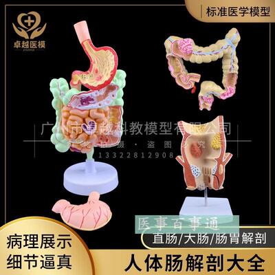 人体大肠病理模型肠胃解剖模型大H肠盲肠直肠十二指肠模型
