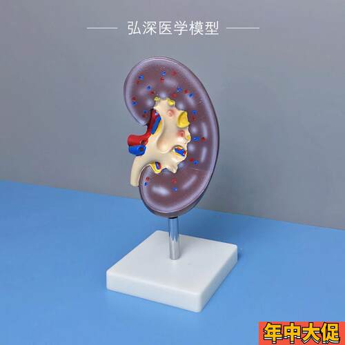 人体肾解剖模型肾脏器官血管内脏结构放I大泌尿系统医学生教学模