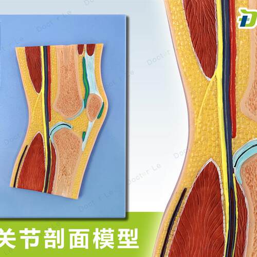 人体断层扫描 膝盖切面浮雕 膝关节断层解剖学Q模型 ct运动解剖