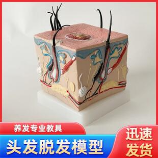 人体毛发脱发模型头发头皮发炎毛细血管J毛囊收缩教学教具演示模