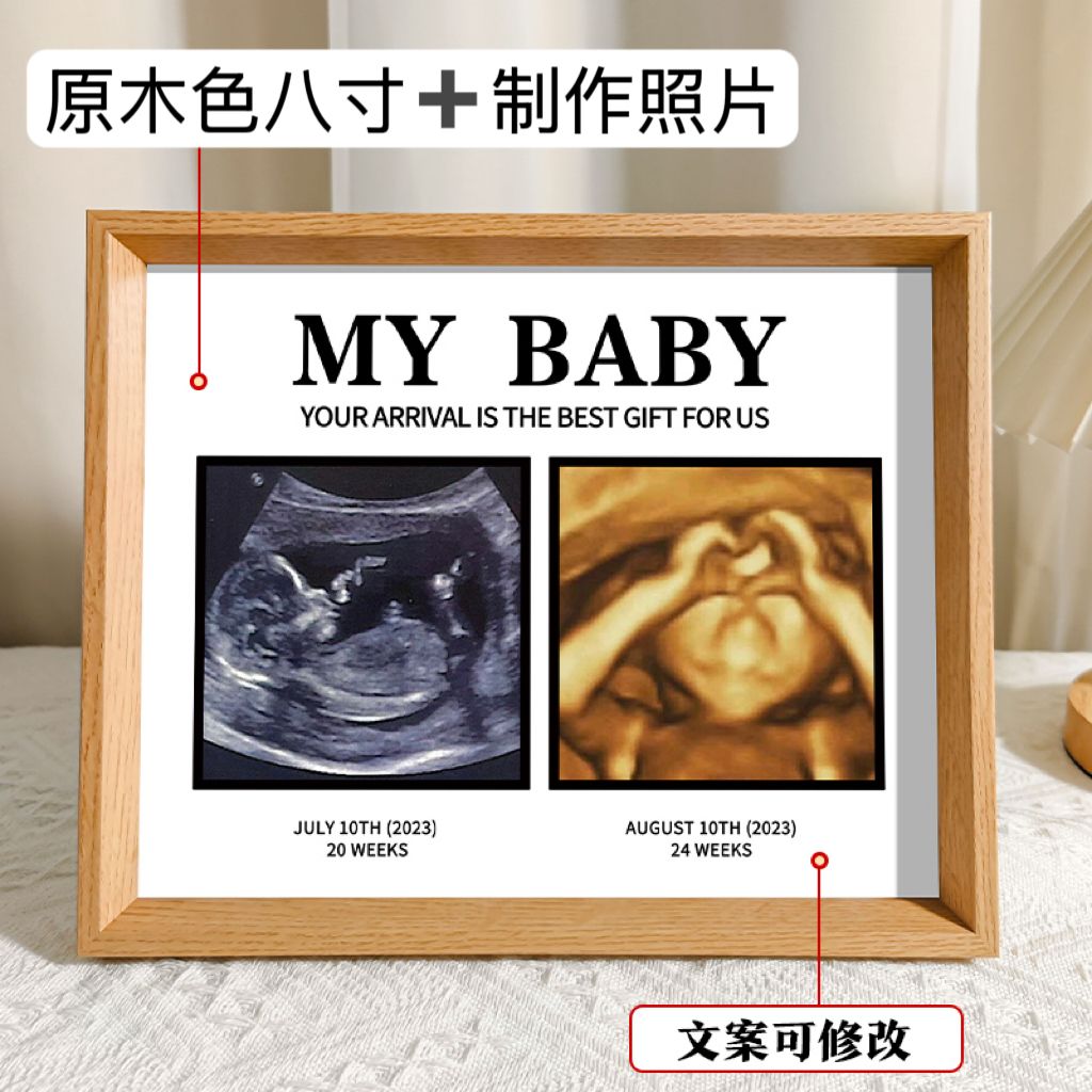 胎儿b超相框宝宝b超四维照片打印婴儿出生礼物摆台相框nt四宫格孕