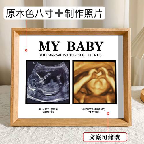 胎儿b超相框宝宝b超四维照片打印婴儿出生礼物摆台相框nt四宫格孕