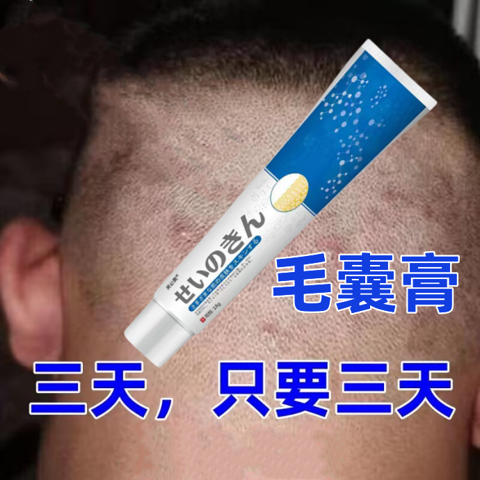 马拉色菌毛囊有炎头痒软膏头部有红疙瘩头皮头上手臂后背长痘痘膏